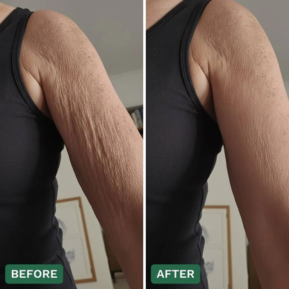 Crepey Skin Repair Cream