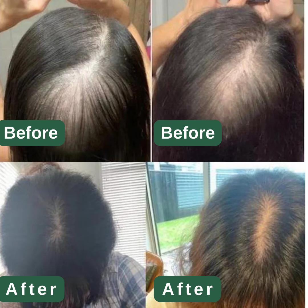 Natural Hair Growth Serum