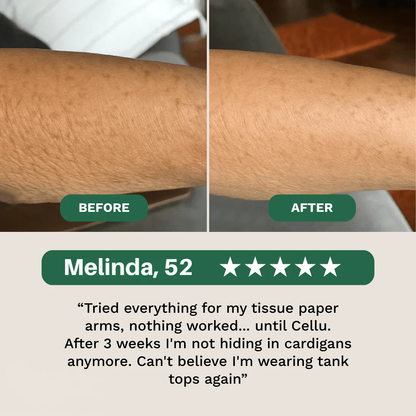 Crepey Skin Repair Cream