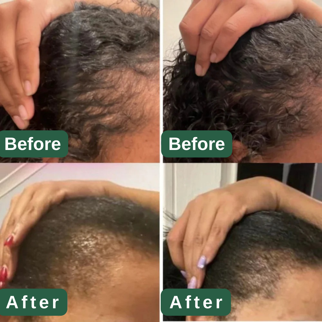 Natural Hair Growth Serum